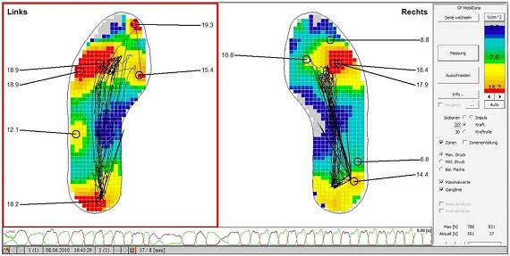 Ganganalyse – Messung der Druckverteilung im Schuh (Insole-System)
