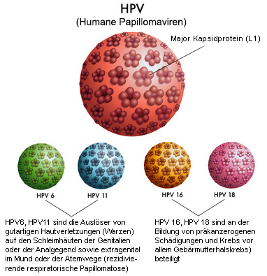 Papillomaviren lösen die Entstehung von Genitalwarzen aus