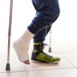 Das Gelenk wird mit einem Gips ruhig gestellt