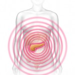 Die akute Form der Bauchspeicheldrüsenentzündung macht sich durch ausstrahlende Schmerzen im Oberbauch bemerkbar
