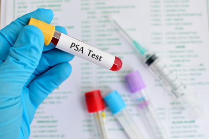 Der Urologe kann verschiedenste Untersuchungen, wie den PSA Test durchführen